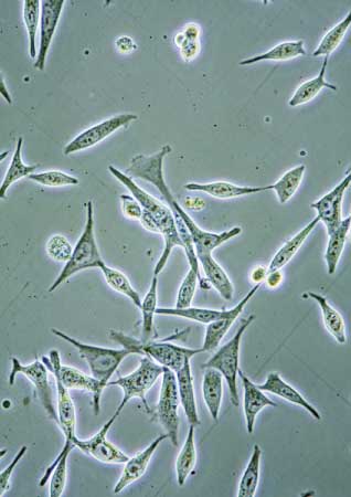 Research Shows BioBank Storage Time May Be As Significant As Sample Provider&rsquo;s Age