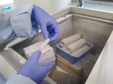 内因性バイオマーカー解析による血清・血漿試料の品質管理