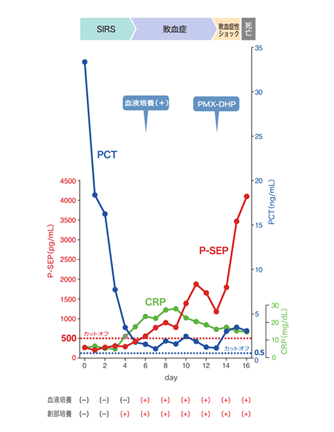 臨床事例（重傷熱傷） イメージ